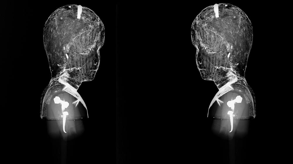Radiografía lateral derecho e izquierdo de la virgen niña. Radiografía: Archivo CNCR (Ossa, C 2011).