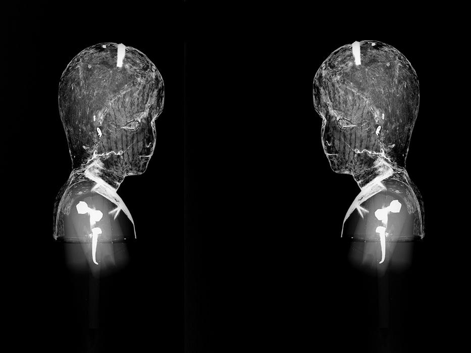 Radiografía lateral derecho e izquierdo de la virgen niña. Radiografía: Archivo CNCR (Ossa, C 2011).