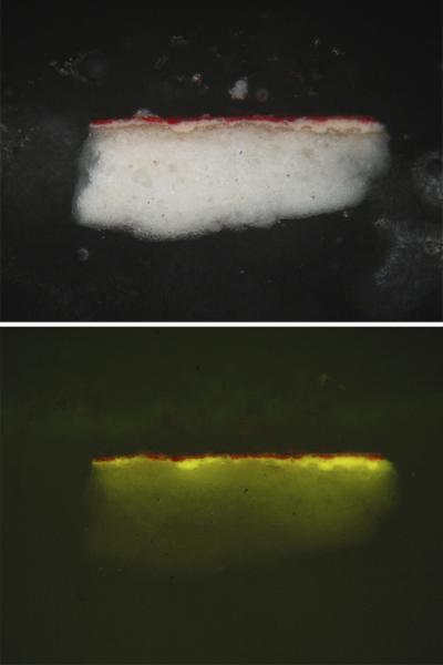 Análisis de cortes estratigráficos, zona tobillo Análisis de cortes estratigráficos, zona tobillo